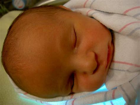 Jaundice In Newborn Baby And Normal Bilirubin Levels In Newborns