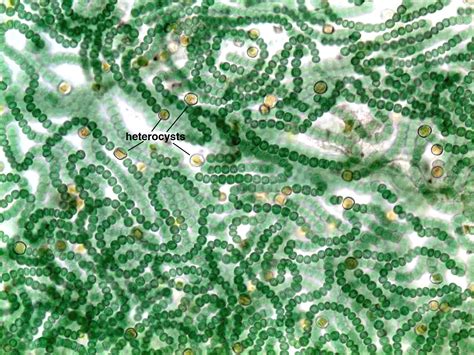 Microscope Nostoc Filament Micropedia