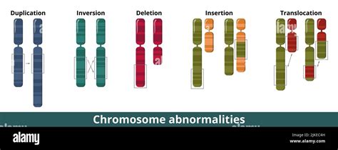 Anomalías Cromosómicas Fotografías E Imágenes De Alta Resolución Alamy
