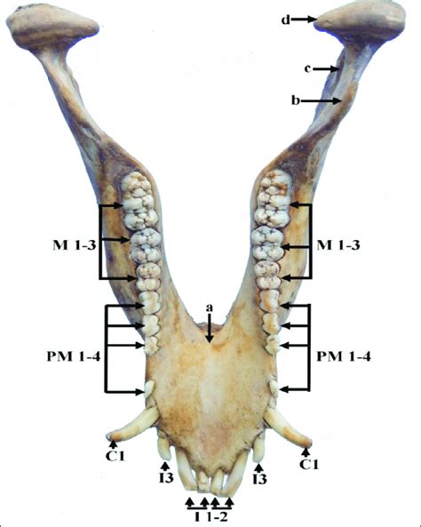 Coronoid Process Of Mandible Slidesharetrick