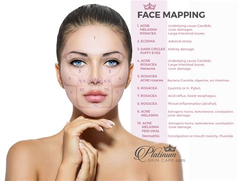 Face Mapping For Acne Face Mapping Face Acne Face Map