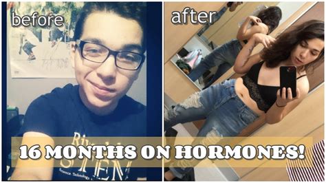16 Months On Hrt Boobs Hair Growth Etc Mtf Transition Youtube