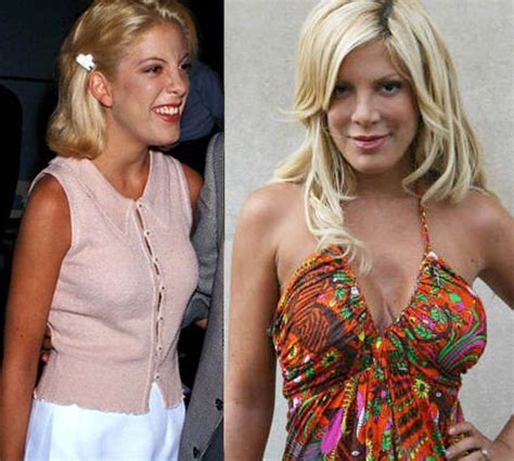 Celebrity Boob Jobs Tori Spelling Plastic Surgery Before And After Vrogue