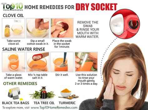 How To Prevent Dry Socket After Wisdom Teeth Removal Spencer Patts