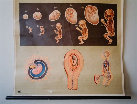 Original Anatomical Vintage German Educational School Wall Chart Gestation Foetus Development