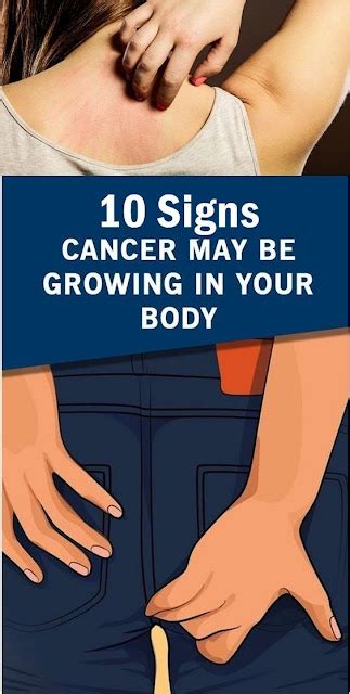 Early Signs That Cancer Is Growing In Your Body Healthy Team