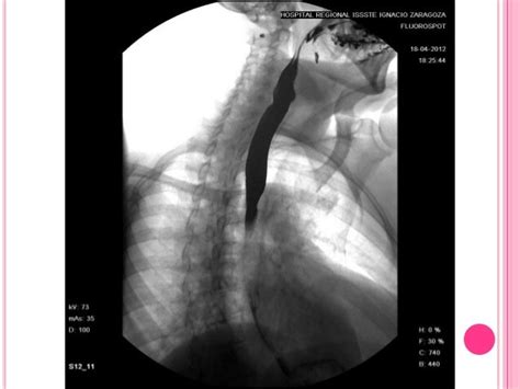 Serie Esofagogastroduodenal