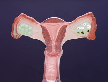 Ciąża Biochemiczna Objawy I Przyczyny Co To Jest Jakie Badania Mobile