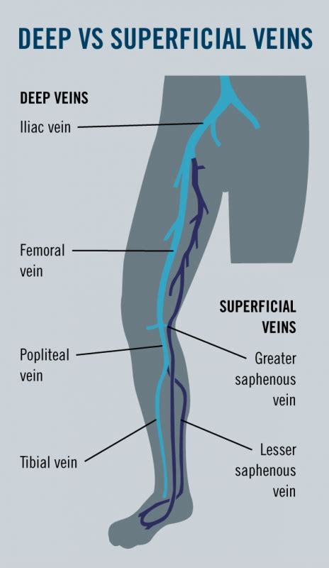 Deep Veins Vs Superficial Veins Whats The Difference Images And