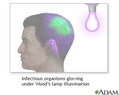 Wood Lamp Examination Uf Health