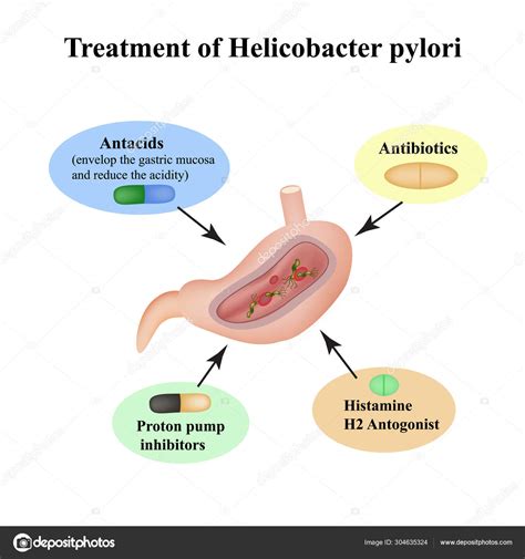 Treatment Of Helicobacter Pylori Medications Antacids Proton Pump Blockers And H2 Histamine