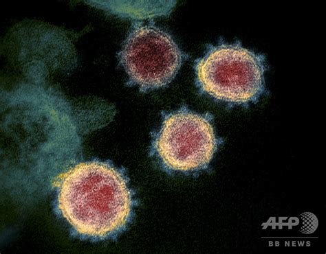 図解新型コロナウイルスの姿 写真11枚 国際ニュースAFPBB News
