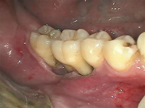 Com July 2008 Diagnosis Uw School Of Dentistry