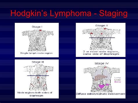Hodgkins And Non Hodgkins Lymphoma Dr Trynaadh