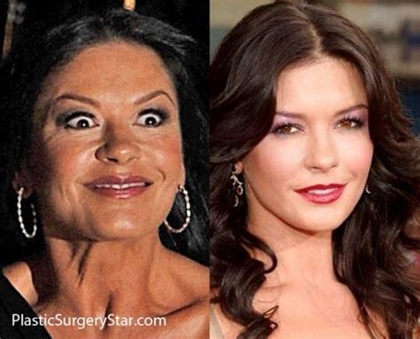 Catherine Zeta Jones Botox Fake Celebrities Celebrities Before And