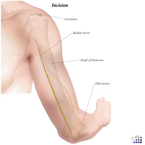 Posterior Approach To Humerus Approaches Orthobullets