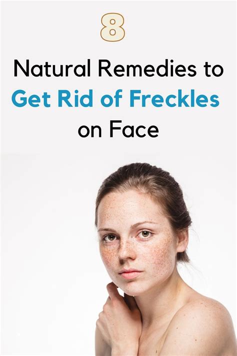8 Natural Remedies To Get Rid Of Freckles On Face Womens Alphabet