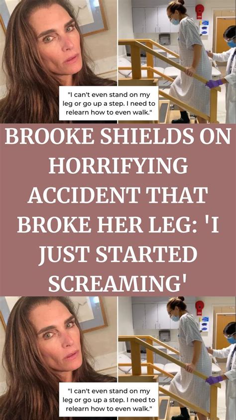 Brooke Shields On Horrifying Accident That Broke Her Leg I Just Started Screaming Brooke