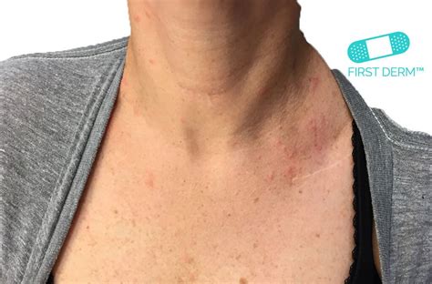 Online Dermatology Itchy Red Rash And Spots On Your Skin