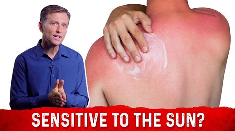 Can You Be Allergic To The Sun Drberg On Sun Allergy And Niacin