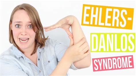 Ehlers Danlos Syndrome Causes Types Symptoms Treatment