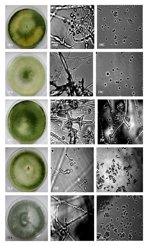 Morphology Conidiophore Spore And Chlamydospore Of Different