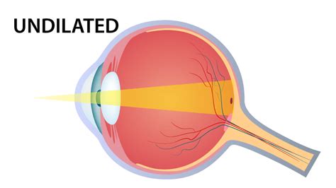Dilated Eye Exams Eye Deology Vision Care Edmonton Optometrists