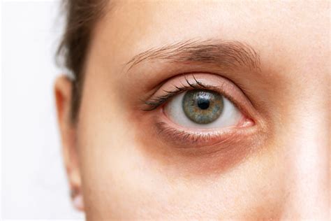 How To Choose The Best Eye Cream For Dark Circles Neutrogena® Skincare