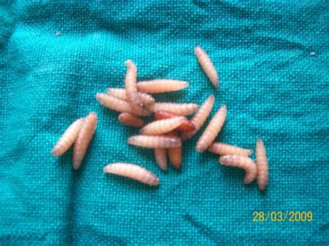 maggots in human nose
