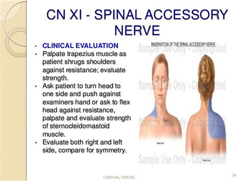 Image Result For Cranial Nerve Xi Test Nurse Teaching Teaching Tools