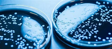 Identify issues before they become problems. Wateradvies en bemonstering voor tandartsen - Hydroscope