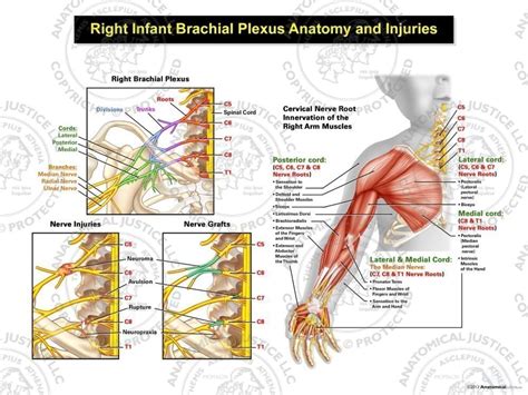 Brachial Plexus Injury Chart