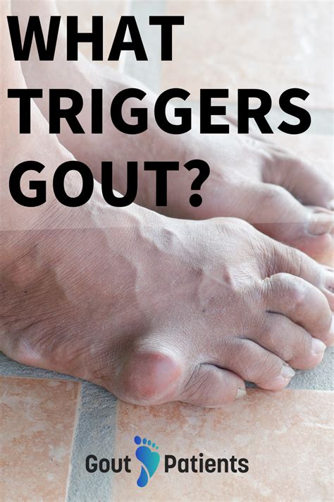 What Does Gout Look Like On The Foot What Does