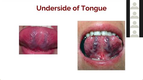 Anatomy Of The Tongue Underneath