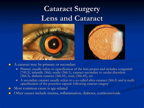 Ppt Cataract Surgery Powerpoint Presentation Free Download Id 4867582