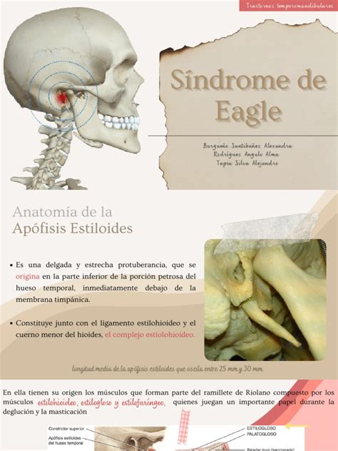 Síndrome De Eagle Pdf Anatomía Medicina Clinica