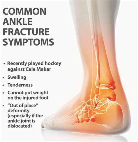 Some Important Info About Common Ankle Injuries Rcoloradoavalanche