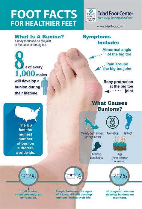Learn more about bunions and how they can be treated! http://www