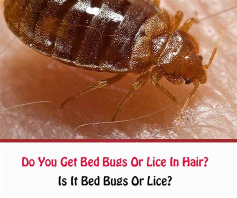 Do You Get Bed Bugs Or Lice In Hair