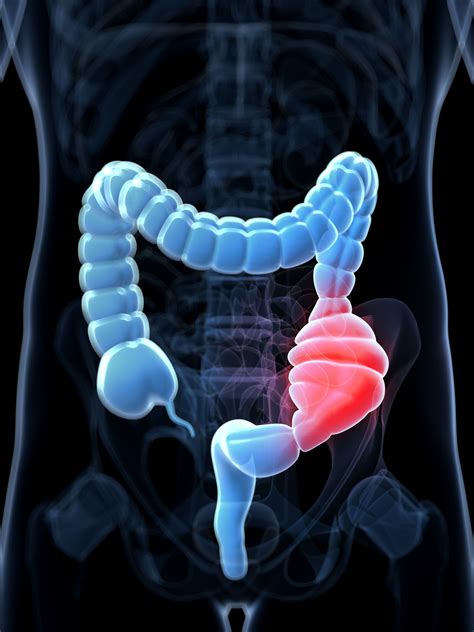 A Guide to Understanding Constipation and Its Treatment