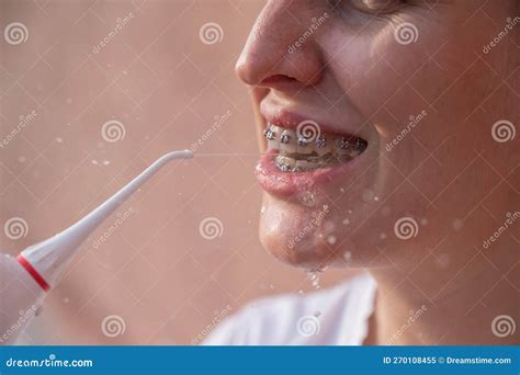 A Woman With Braces On Her Teeth Uses An Irrigator Close Up Portrait Stock Image Image Of