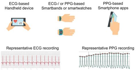 Remote Heart Rhythm Assessment By A Smartphone Camera The