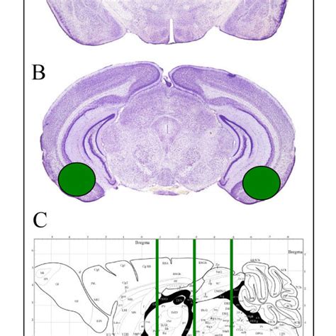 Denervation Of The Outer Molecular Layer Of The Dentate Gyrus After