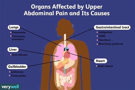 What Causes Upper Abdominal Pain