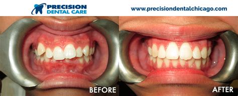 All of the team at precision dental, cosmetic & implant clinic in rotherham share the same values and. Precision Dental Care | The Best Dentists in Chicago IL