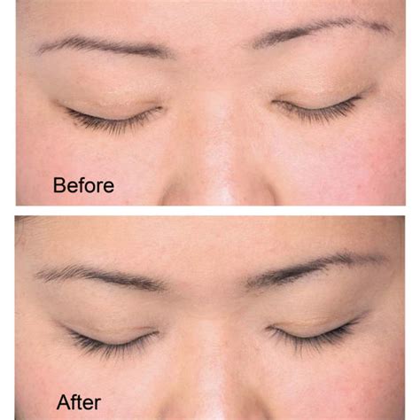 At rapidlash® we strive to provide our customers with the finest quality lash and brow. RapidLash Eyelash Enhancing Serum