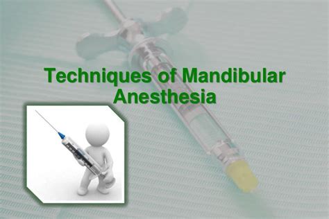 Mandibular Injections