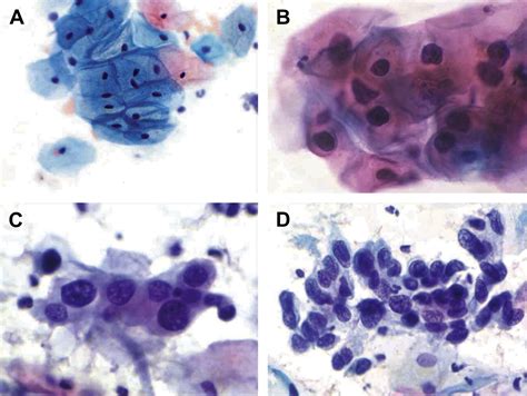 Overview Of The Cytology Laboratory Specimen Processing Through