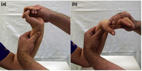 Differential Diagnosis Of Ulnar Side Wrist Pain Rehand