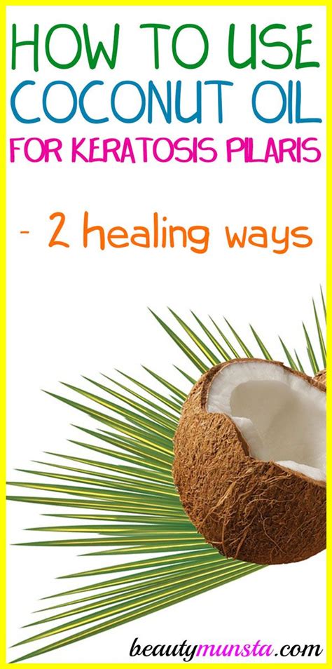 Coconut Oil For Keratosis Pilaris How To Use Beautymunsta Free
